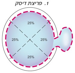 פריצת דיסק