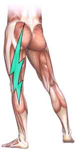 Read more about the article Sciatica – סיאטיקה פסיכוסומטית