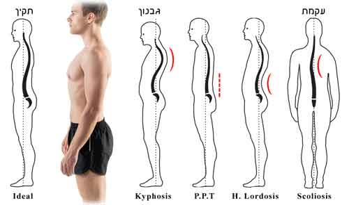 Read more about the article יציבה תקינה