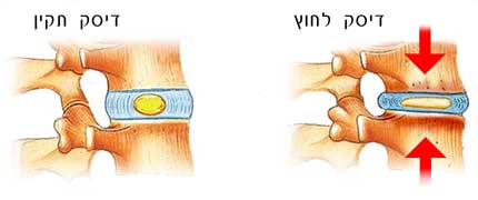 בלט דיסק